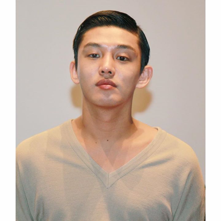 Yoo Ah In được chuẩn đoán bị u xương