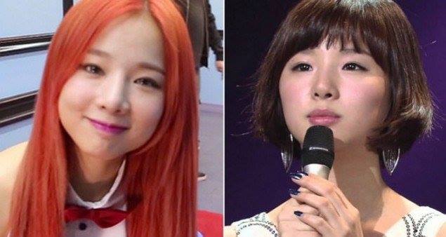 News: EXID Solji từng phẫu thuật thẩm mỹ?!