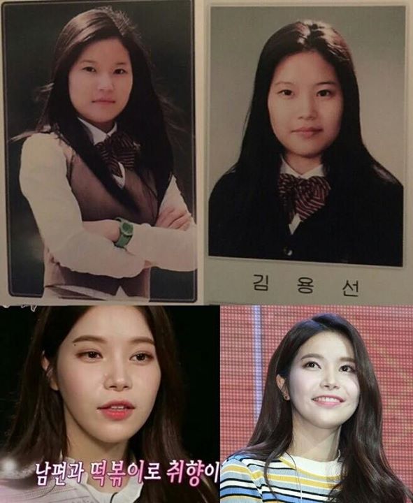 Instiz: Ảnh quá khứ của MAMAMOO Solar *người từng có tin đồn phẫu thuật thẩm mĩ toàn bộ để trở thành ca sĩ