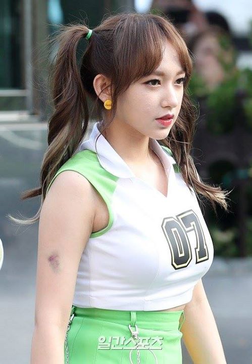 B&agrave;i b&aacute;o: Sungso 'vết th&acirc;m t&iacute;m tr&ecirc;n c&aacute;nh tay'