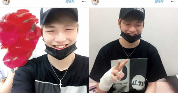 Kang Daniel (Produce 101) gặp chấn thương tay