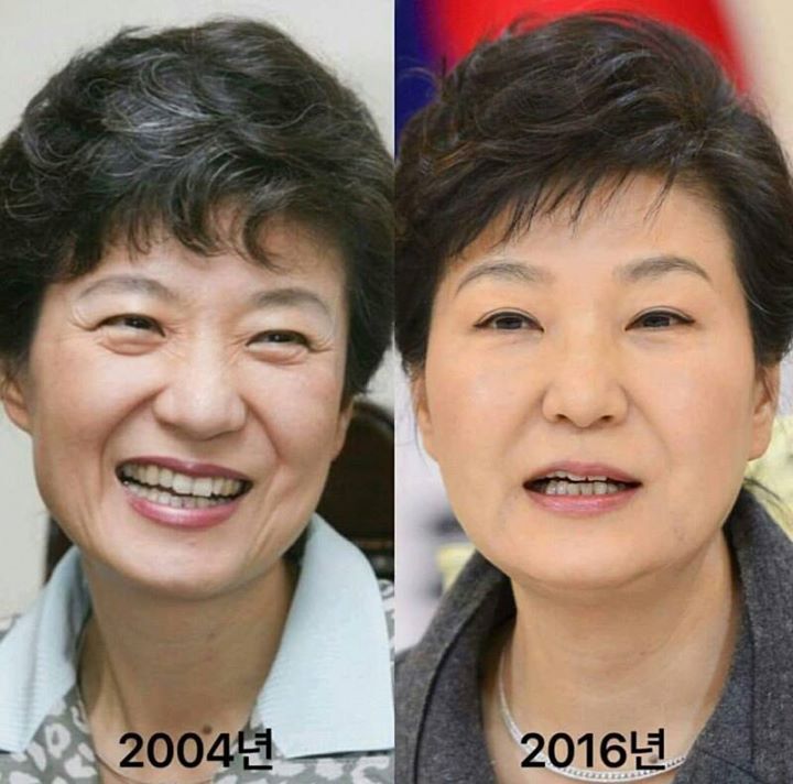 Pann: Cuộc đời Park Geun Hye trước và sau khi tiêm botox  